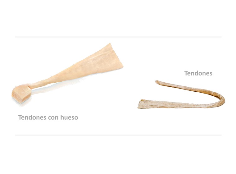 GraftNET Tendones y Ligamentos